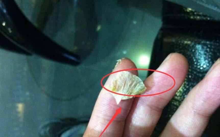 为什么有人"耳屎"是油性的,有的是干的?掏耳屎好吗?你