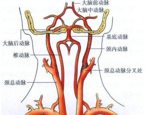 颈动脉一旦被堵人体哪个部位反应最强烈