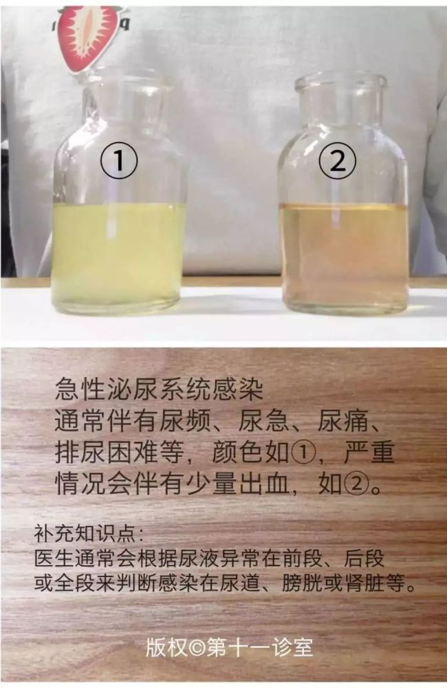 说起尿液的气味,其实分为新鲜和陈旧两种.