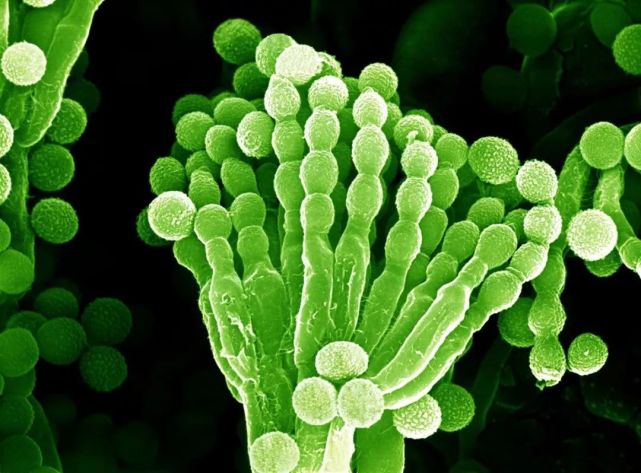 扫描电子显微镜下的青霉菌,生长出孢子链