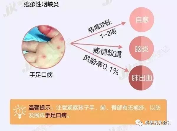 家长们可以先从一张图认识什么是疱疹性咽峡炎妈妈们一定要保护好