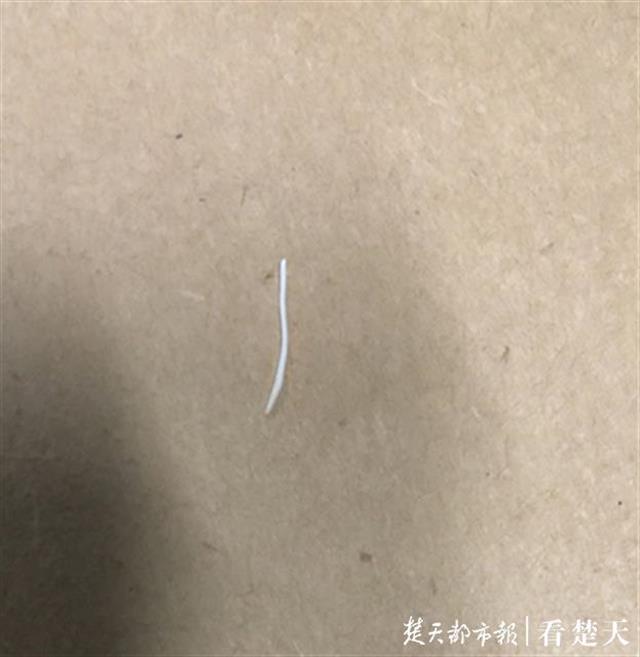 倔强老人和鱼刺较劲六天险窒息,医生这样提醒