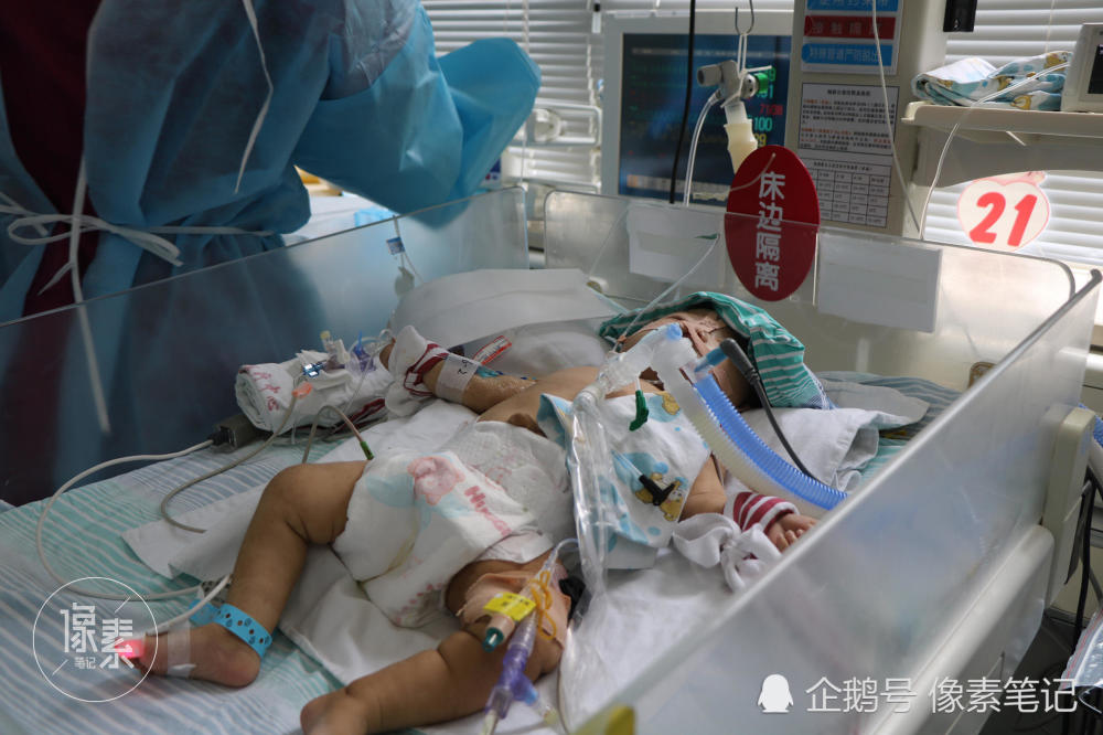 未满五个月大女儿患先天性心脏病:家人都劝我放弃,可
