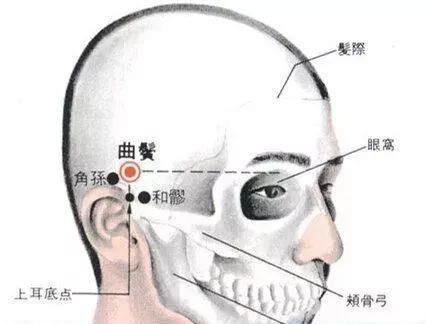 每日一穴曲鬓穴清热止痛散风消肿