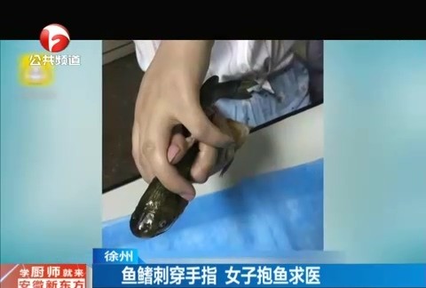 女子抱着鱼来到急诊室,医生肯定了她的做法