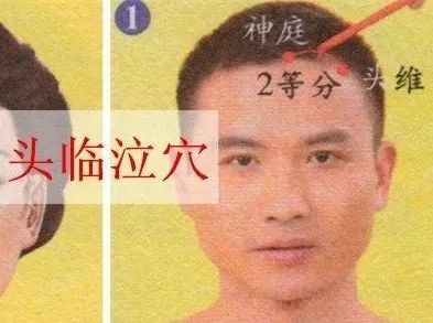 头临泣为经穴名(tóulínqì).出《针灸甲乙经》.