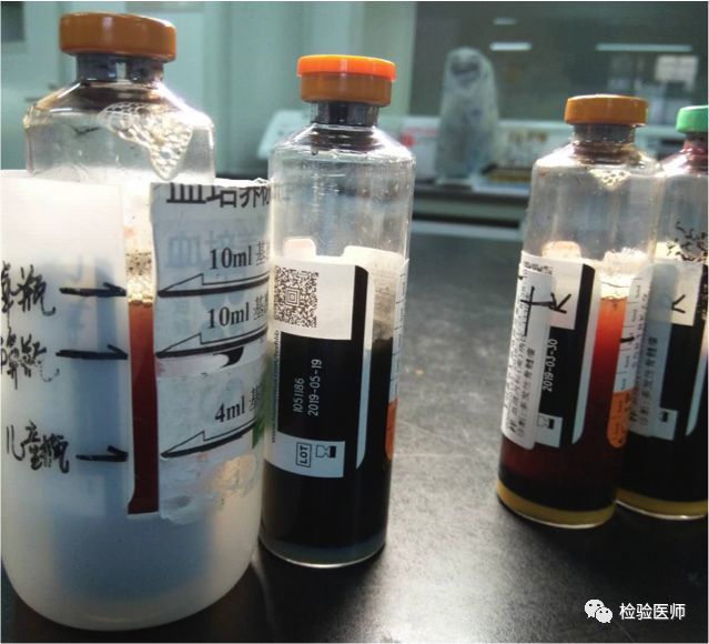 多个指南不统一儿童血培养到底该抽几毫升