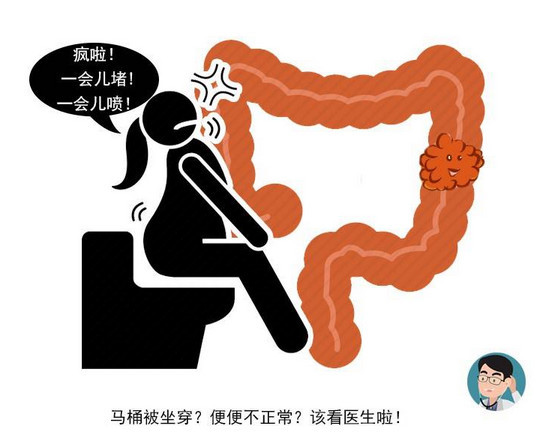 排便出血,究竟该如何分辨是肠癌还是痔疮呢?通过5点