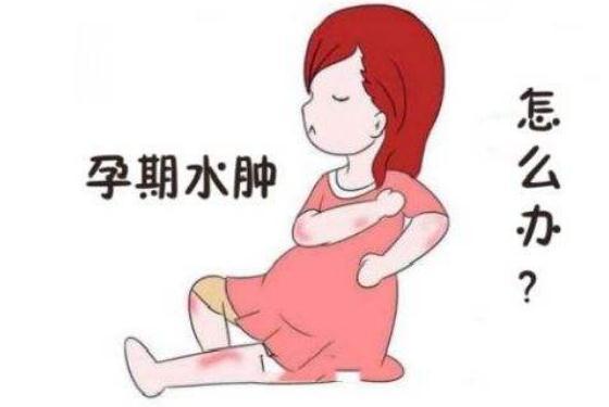 孕期什么阶段易水肿?水肿后该怎么办?