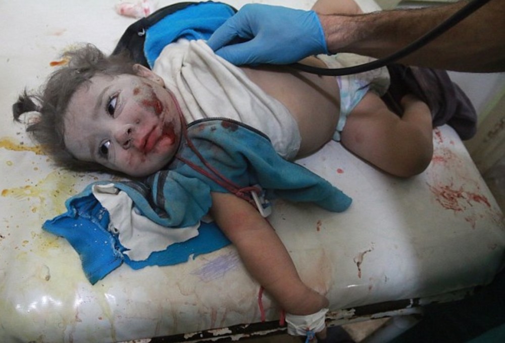 这名在叙利亚的英国医生 7天救下了110名儿童