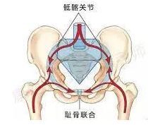 骶髂关节错位是下腰痛的原因之一