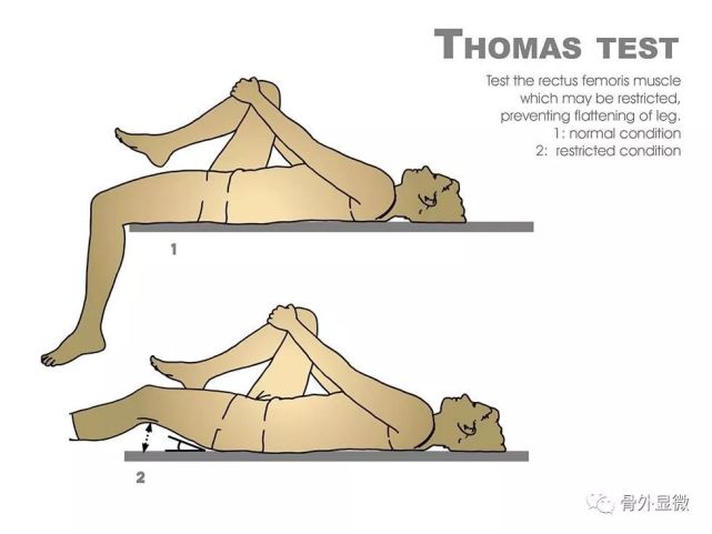 试验)是一项体检,以英国矫形外科医生hugh owen thomas博士(1834-1891