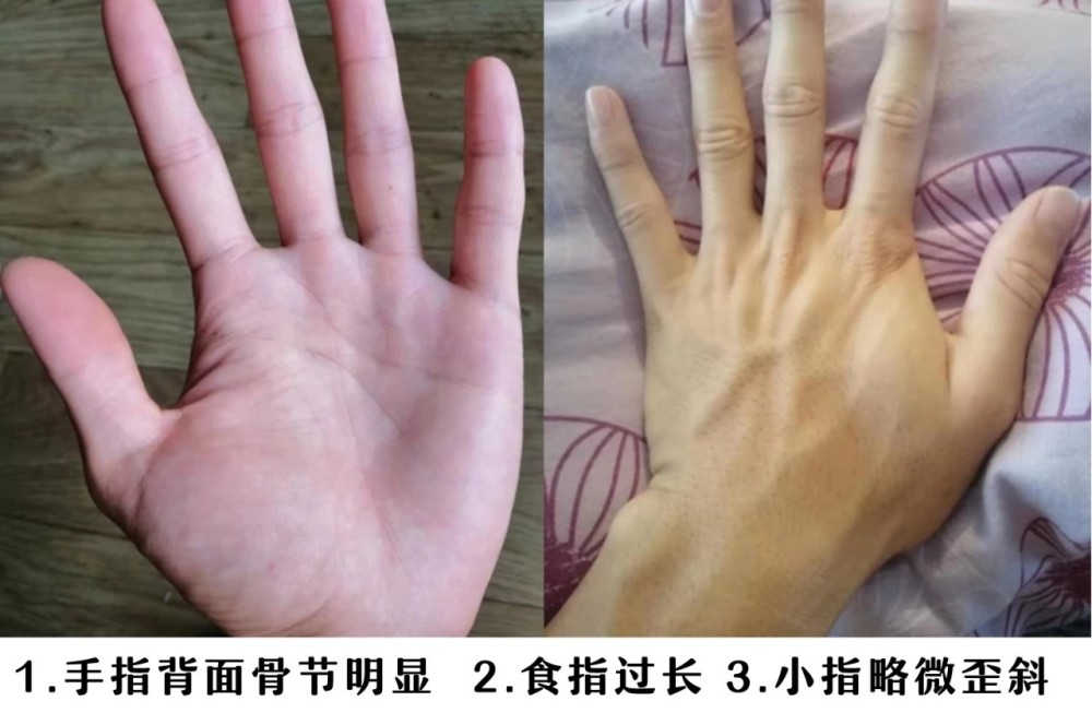 一,木形手和金形手(手指骨头比肉多,指头较短)