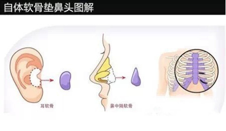 明星都在做的整容鉴定是啥