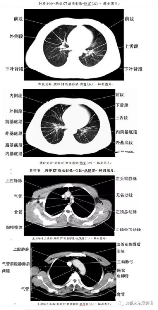 『临床』史上最全,全身ct图谱