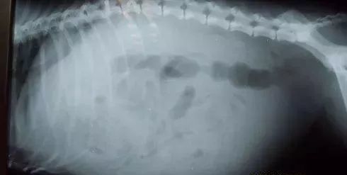 【昆明南亚科大肝病医院】腹水的四个阶段以及腹水的认识误区!