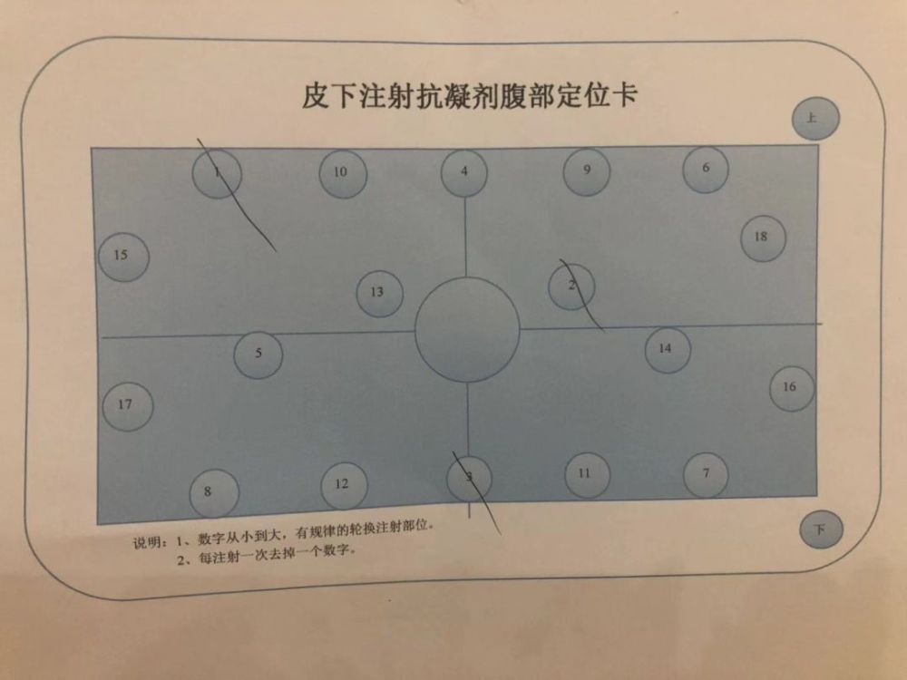 选择腹部进行皮下注射,选择脐周上下5 cm,10 cm 范围内(除脐周1 cm)