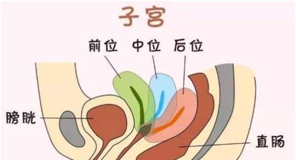 2,子宫前位 女性子宫的体位一般分为前位,中位和后位,如下图所示