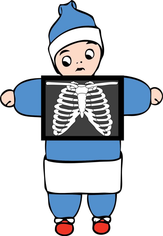 而这些参与者的胸片中,放射科的医生也发现了 肺结节,肺不张,肺纤维化