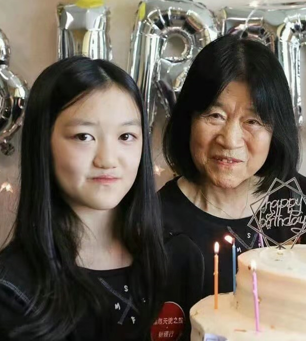13岁李嫣再做兔唇矫正手术,嘴型修复成功,却因鼻子惹