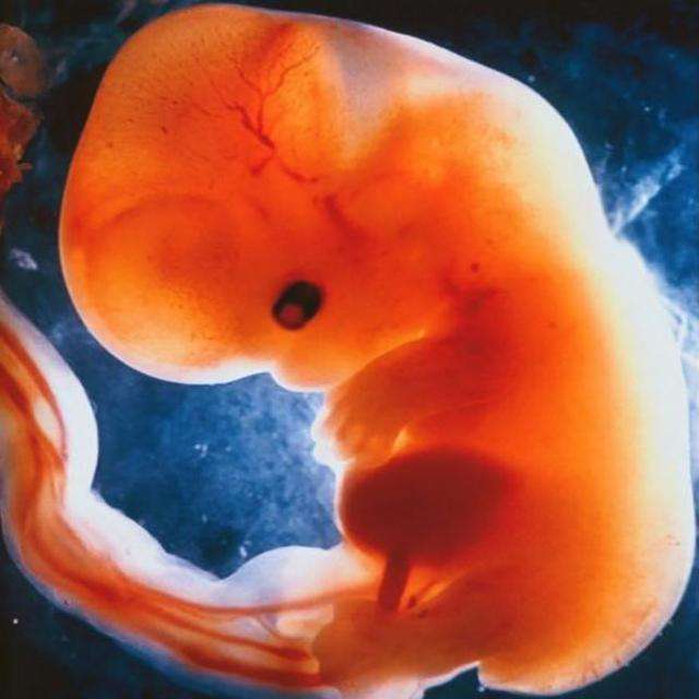 怀孕5-9周,"胚胎"分化成"胎儿",生命是这么神奇!附注意点