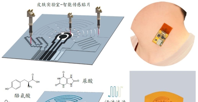 可实时监测糖尿病伤口状态和葡萄糖的新型水凝胶敷料光学传感器