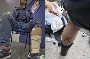 小腿中箭几乎穿透 受伤港警:很羡慕内地警察