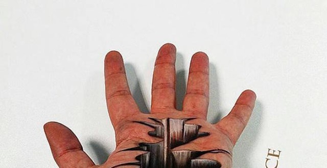 治疗感染性湿疹样皮炎有妙招 你知道吗