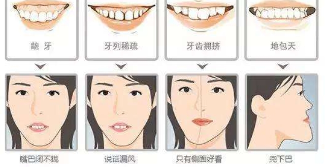 牙齿矫正对脸型有什么影响呢?