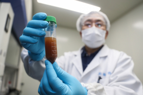 病毒怎么检查_检查乙肝病毒_检查hpv病毒
