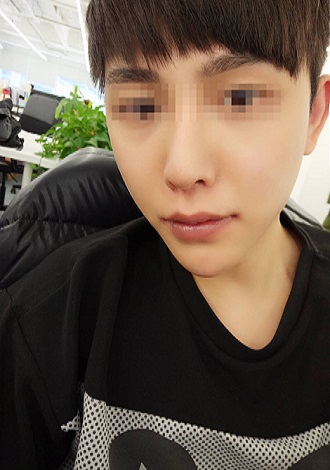 调查显示七成整容者向对象隐瞒