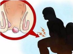 痔疮最佳的自愈方法?中医常用的一方一按,精准解决痔疮问题!