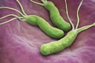 感染幽门螺杆菌，就会得胃癌吗？