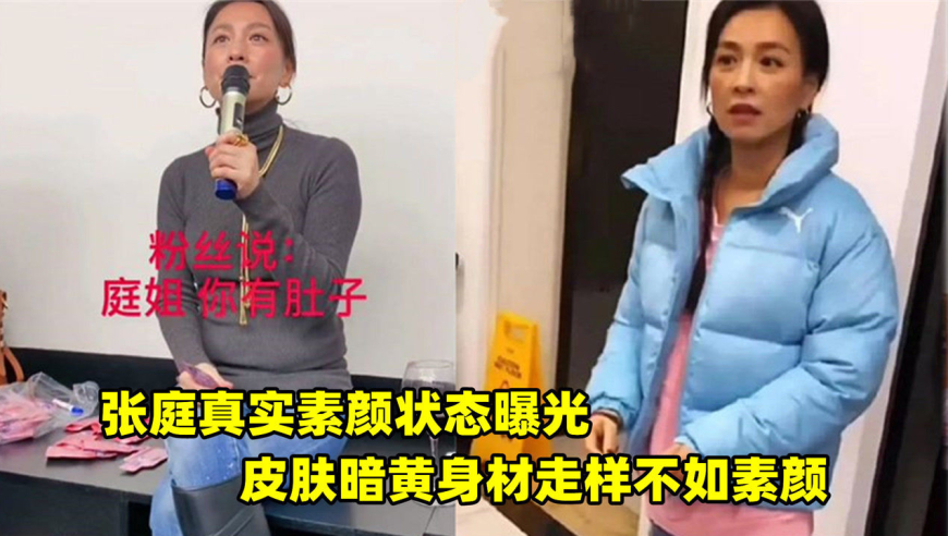 张庭真实素颜罕见曝光!皮肤暗黄身材走样,整个人状态还不如素人