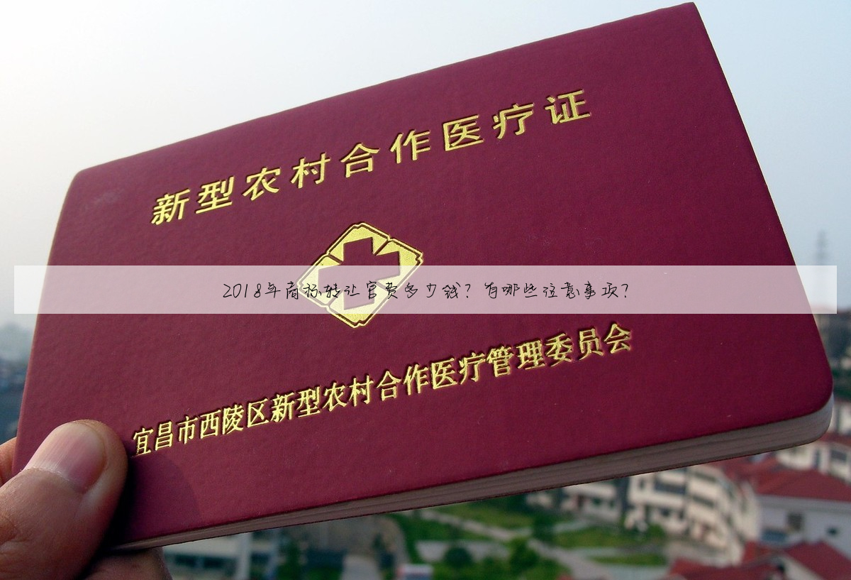 2018年商标转让官费多少钱?有哪些注意事项?