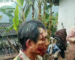 云南一老人两次被熊袭击 “倒地装死”逃生