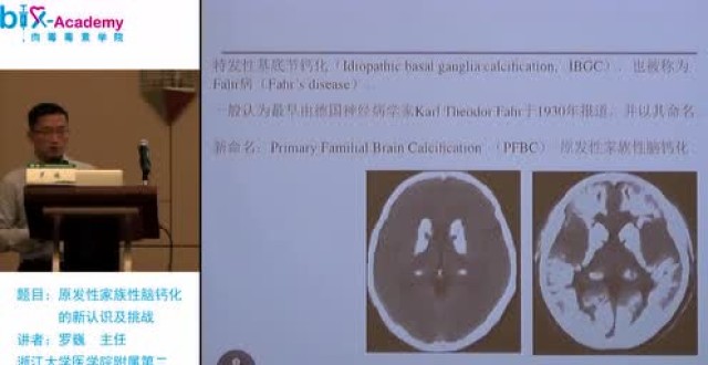 浙江大学医学院附属第二医院神经内科罗巍老师