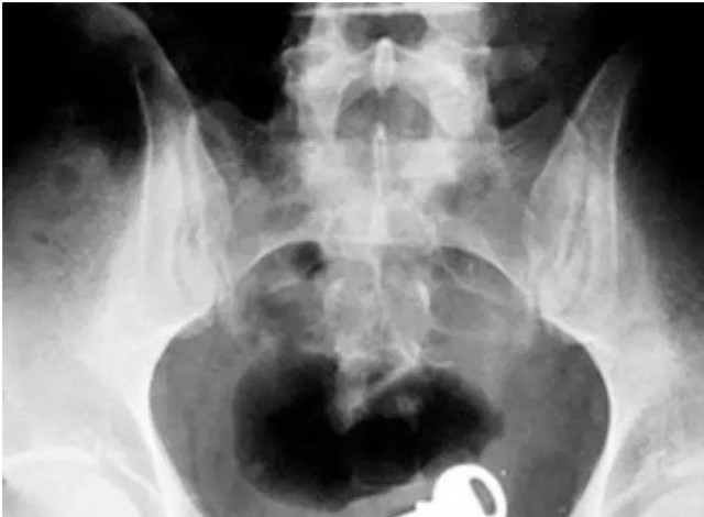 华为全新处理器麒麟710曝光