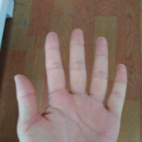 最贵;小米手机被摔碎,价值10万;网友;雷军看着