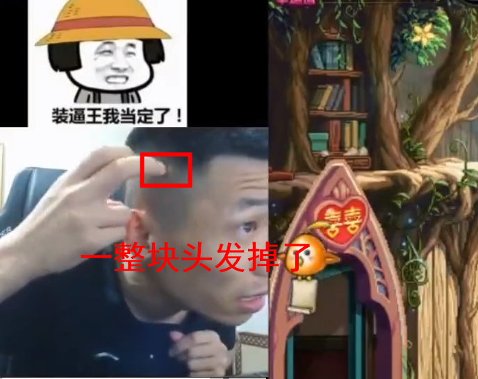 因为他后面的头发看上去是掉得一块块的,有些像癞子头了,就是局部脱发