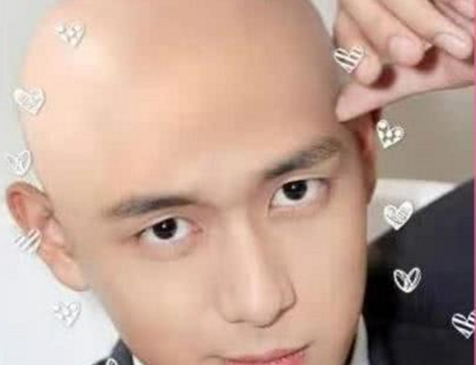 本以为李现不适合剃光头,直到看见他唯一一张光头,网友:a爆了