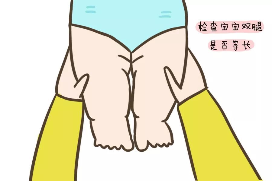 腿纹/臀纹不对称就是髋关节发育有问题?学会自查方法