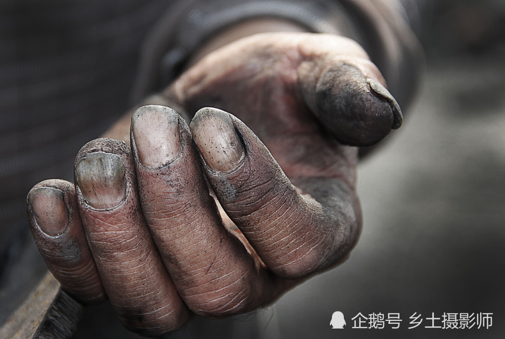 图为淮北段园镇牛眠村民工冯大叔长期粉碎煤矸石手上磨满了粗糙的肉茧
