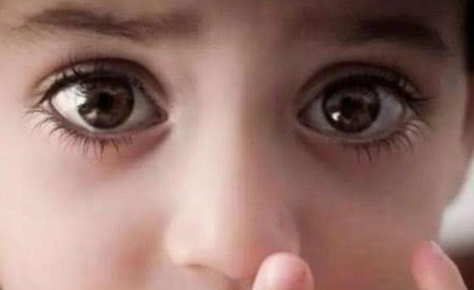 青春期最"伤"眼睛的3行为,玩手机排不上号,你敢说都没
