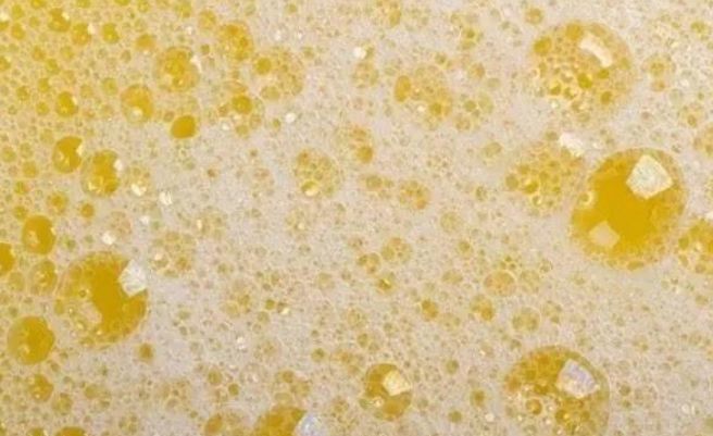 48岁男子,确诊尿毒症,需终身透析,2件事做太多,肾伤得