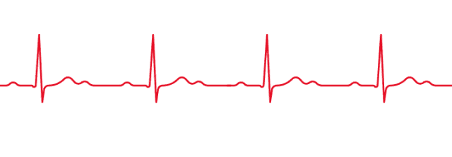 心电图报告单教你这几招轻松看懂