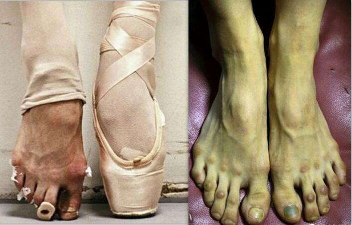 有一种痛叫做芭蕾舞者的脚,看到脚上的伤痕:你配叫白天鹅!