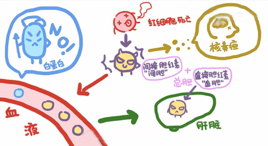 专家解析:为什么胆红素是引起新生儿黄疸的罪