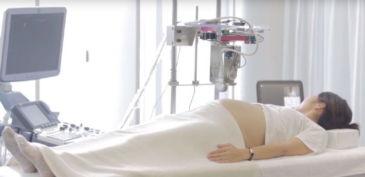 孕妇b超体检未来将由ai机器人代劳