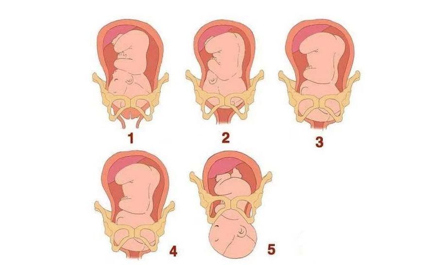 立秋,自然分娩,孕妇,子宫颈,第一产程,产程